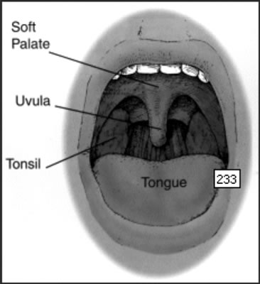tonsil